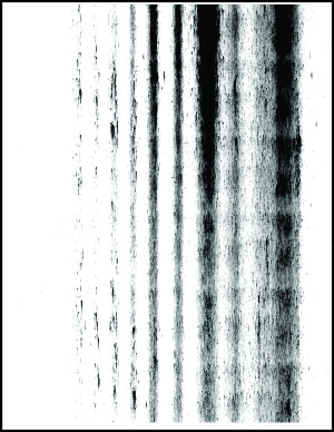 forklædt Arkæolog Transplant Vertical dark streaks with print missing | Lexmark MS823